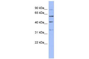 WB Suggested Anti-PRPF4 Antibody Titration:  0.