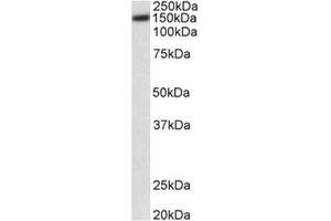 AP31703PU-N (0. (ATP2B1 anticorps  (Internal Region))