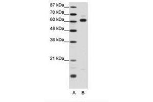 Image no. 1 for anti-Thyroid Hormone Receptor Interactor 4 (TRIP4) (AA 191-240) antibody (ABIN202787) (TRIP4 anticorps  (AA 191-240))