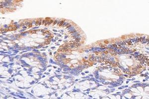 Immunohistochemistry analysis of paraffin-embedded rat colonitis using,FGF10 (ABIN7073940) at dilution of 1: 8000 (FGF10 anticorps)
