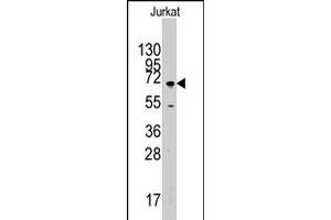 Western blot analysis of MAPK4 polyclonal antibody  in Jurkat cell lysate (35 ug/lane).