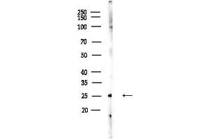 anti-Ras Homolog Family Member H (RHOH) (Internal Region) antibody