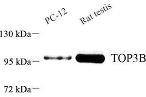 Western blot analysis of TOP3B (ABIN7075940) at dilution of 1: 800 (TOP3B anticorps)