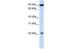 TMTC4 antibody used at 1 ug/ml to detect target protein. (TMTC4 anticorps  (C-Term))