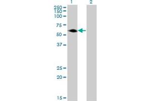 Western Blot analysis of AGER expression in transfected 293T cell line by AGER monoclonal antibody (M05), clone 1D1. (RAGE anticorps  (AA 87-197))