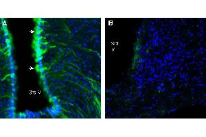 Expression of GABA(A) Receptor Beta 2 in mouse hypothalamus.