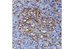 Immunohistochemistry of paraffin-embedded mouse spleen using HLA-B antibody (ABIN1513015, ABIN3021868, ABIN3021869 and ABIN6216628) at dilution of 1:100 (40x lens).