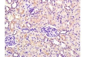 Paraformaldehyde-fixed, paraffin embedded Mouse kidney; Antigen retrieval by boiling in sodium citrate buffer (pH6.