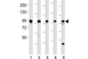 Western blot testing of EZH2 antibody at 1:2000 dilution.