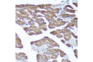 Immunohistochemistry of paraffin-embedded Rat heart using TIMMDC1 Rabbit pAb (ABIN7270929) at dilution of 1:100 (40x lens). (TIMMDC1 anticorps  (AA 206-285))
