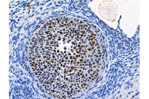 Phospho-MCM2 (Ser41) Antibody at 1/100 staining Rat ovarian tissue by IHC-P. (MCM2 anticorps  (pSer41))
