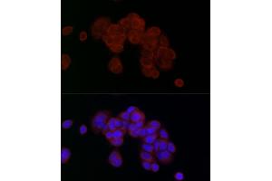 Immunofluorescence analysis of MCF7 cells using PG Rabbit pAb (ABIN7269317) at dilution of 1:25 (40x lens).