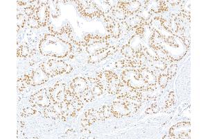 Immunohistochemistry (IHC) image for anti-ThPok (AA 250-300) antibody (ABIN7455169) (Recombinant ThPok (AA 250-300) anticorps)