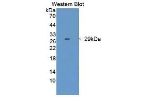 Detection of Recombinant WASP, Human using Polyclonal Antibody to Wiskott Aldrich Syndrome Protein (WASP) (WASP anticorps  (AA 39-251))