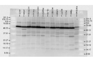 Hsp70, human cell lines, polyclonal (HSP70 anticorps)