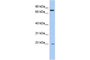 WB Suggested Anti-NHLRC2 Antibody Titration: 0. (NHLRC2 anticorps  (N-Term))