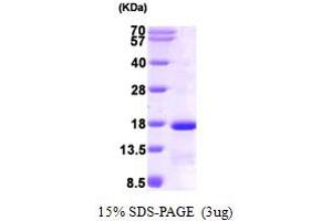 SDS-PAGE (SDS) image for Eukaryotic Translation Initiation Factor 1 (EIF1) (AA 1-113) protein (His tag) (ABIN668051)