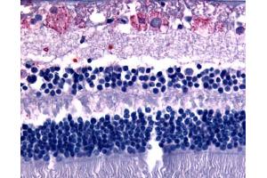Anti-GPR75 antibody IHC of human eye, retina. (GPR75 anticorps  (C-Term))