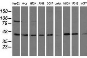 Western blot analysis of extracts (35 µg) from 9 different cell lines by using anti-ALDH1L1 monoclonal antibody. (ALDH1L1 anticorps)