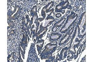 IHC analysis of Agrin/AGRN using anti-Agrin/AGRN antibody (ABIN7600387). (AGRN anticorps  (AA 1864-2068))