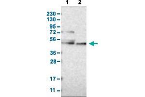 Western Blot analysis with CYP26B1 polyclonal antibody . (CYP26B1 anticorps  (AA 201-310))
