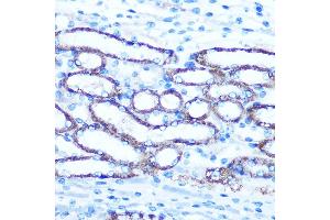 Immunohistochemistry of paraffin-embedded Mouse kidney using TBCCD1 Rabbit pAb (ABIN7270751) at dilution of 1:100 (40x lens).