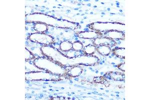 Immunohistochemistry of paraffin-embedded Mouse kidney using TBCCD1 Rabbit pAb (ABIN7270751) at dilution of 1:100 (40x lens). (TBCCD1 anticorps)