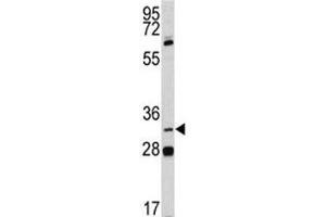 Western blot analysis of PITX1 antibody and NCI-H460 lysate.