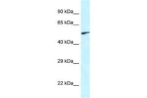 WB Suggested Anti-Eya2 Antibody Titration: 1. (EYA2 anticorps  (Middle Region))