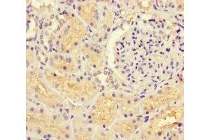Immunohistochemistry of paraffin-embedded human kidney tissue using ABIN7154769 at dilution of 1:100 (GUCY1A1 anticorps  (AA 20-152))
