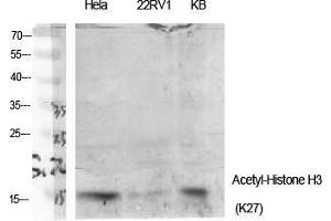 Western Blot (WB) analysis of specific cells using Acetyl-Histone H3 (K27) Polyclonal Antibody.