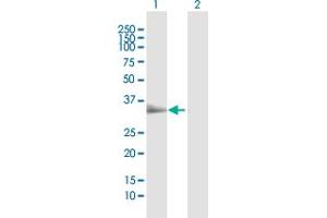 Western Blot analysis of TIRAP expression in transfected 293T cell line by TIRAP MaxPab polyclonal antibody.
