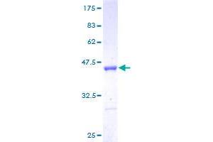 Image no. 1 for LSM5 Homolog, U6 Small Nuclear RNA Associated (LSM5) (AA 1-91) protein (GST tag) (ABIN1309850)