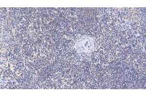 Detection of b2M in Human Spleen Tissue using Monoclonal Antibody to Beta-2-Microglobulin (b2M)