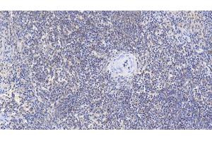 Detection of b2M in Human Spleen Tissue using Monoclonal Antibody to Beta-2-Microglobulin (b2M) (beta-2 Microglobulin anticorps  (AA 22-119))