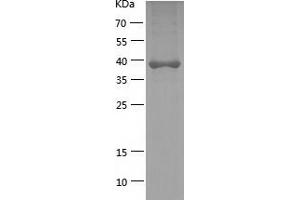 Western Blotting (WB) image for Glycerol-3-Phosphate Dehydrogenase 1 (Soluble) (GPD1) (AA 1-349) protein (His-IF2DI Tag) (ABIN7123157)