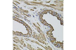 Immunohistochemistry of paraffin-embedded human prostate using FLNB antibody. (FLNB anticorps)