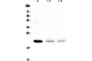 Western blot analysis of BNIP3 using anti-BNIP3 antibody .