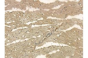 LMOD2 Mouse Monoclonal Antibody at 1/100 staining rat heart tissue by IHC-P.