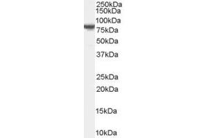 Western Blotting (WB) image for anti-Excision Repair Cross-Complementing Rodent Repair Deficiency, Complementation Group 6-Like 2 (ERCC6L2) (C-Term) antibody (ABIN2785696)