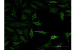 Immunofluorescence of monoclonal antibody to C14orf129 on HeLa cell. (GSKIP anticorps  (AA 1-139))