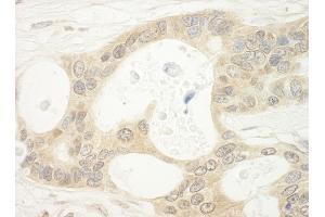 Immunohistochemistry (IHC) image for anti-Folliculin (FLCN) (AA 1-50) antibody (ABIN7448434) (FLCN anticorps  (AA 1-50))