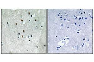 Immunohistochemistry analysis of paraffin-embedded human brain tissue using SRF (Phospho-Ser77) antibody.