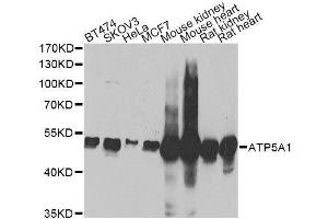 Western blot analysis of extracts of various cell lines, using ATP5A1 Antibody. (ATP5A1 anticorps)