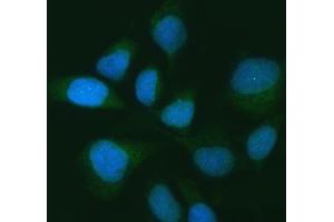 IF analysis of USP16 using anti-USP16 antibody (ABIN7599650).