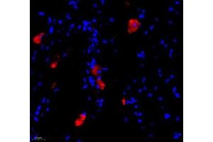 Immunofluorescence of paraffin embedded mouse lymph node using BIRC3 (ABIN7073179) at dilution of 1: 1000 (400x lens) (BIRC3 anticorps)