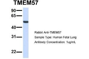 Host:  Rabbit  Target Name:  TMEM57  Sample Type:  Human Fetal Lung  Antibody Dilution:  1. (TMEM57 anticorps  (N-Term))