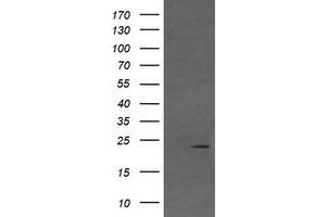 Image no. 3 for anti-Von Hippel-Lindau Tumor Suppressor, E3 Ubiquitin Protein Ligase (VHL) antibody (ABIN1501712)