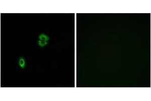 Immunofluorescence (IF) image for anti-Chemokine (C-C Motif) Receptor 7 (CCR7) (AA 170-219) antibody (ABIN2890754) (CCR7 anticorps  (AA 170-219))