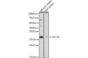 Western blot analysis of extracts of various cell lines, using CLEC4E antibody (ABIN7265982) at 1:1000 dilution. (CLEC4E anticorps)